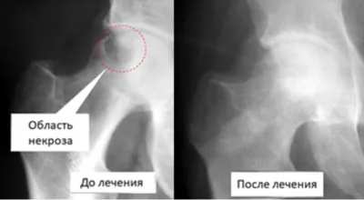 Кому доверить лечение артроза?