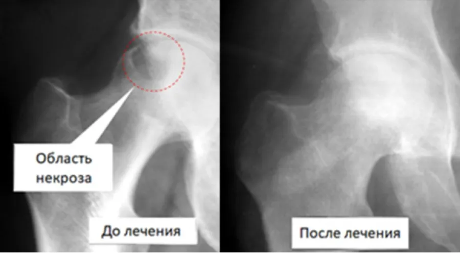 Кому доверить лечение артроза?
